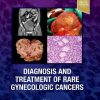 Diagnosis and Treatment of Rare Gynecologic Cancers (Original PDF from Publisher)