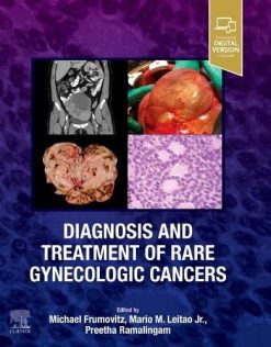Diagnosis and Treatment of Rare Gynecologic Cancers (Original PDF from Publisher)