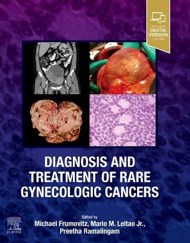 Diagnosis and Treatment of Rare Gynecologic Cancers (Original PDF from Publisher)