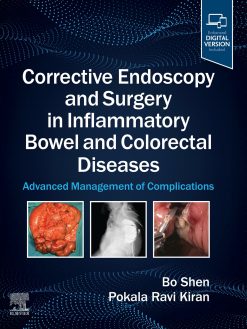 Corrective Endoscopy and Surgery in Inflammatory Bowel and Colorectal Diseases: Advanced Management of Complications (EPUB)