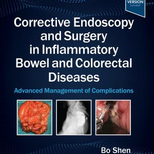 Corrective Endoscopy and Surgery in Inflammatory Bowel and Colorectal Diseases: Advanced Management of Complications (EPUB)