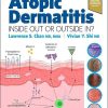 Atopic Dermatitis: Inside Out or Outside In (Original PDF from Publisher)