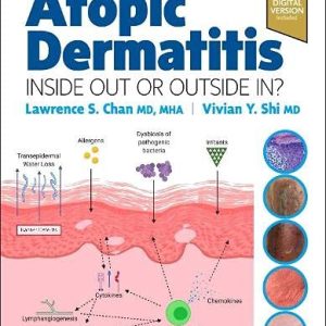 Atopic Dermatitis: Inside Out or Outside In (Original PDF from Publisher)
