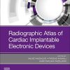 Radiographic Atlas of Cardiac Implantable Electronic Devices (Original PDF from Publisher)