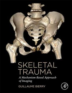 Skeletal Trauma: A Mechanism-Based Approach of Imaging (Original PDF from Publisher)