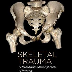 Skeletal Trauma: A Mechanism-Based Approach of Imaging (Original PDF from Publisher)