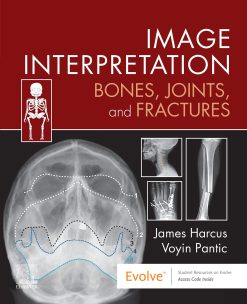 Image Interpretation: Bones, Joints, and Fractures (EPUB)