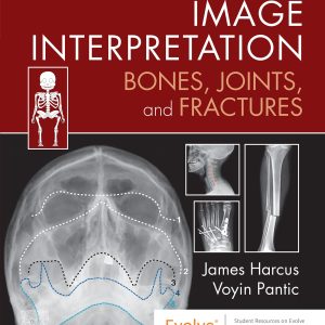 Image Interpretation: Bones, Joints, and Fractures (EPUB)