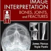 Image Interpretation: Bones, Joints, and Fractures (Original PDF from Publisher)