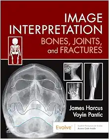 Image Interpretation: Bones, Joints, and Fractures (Original PDF from Publisher)