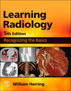 Learning Radiology, 5th Edition (EPUB)