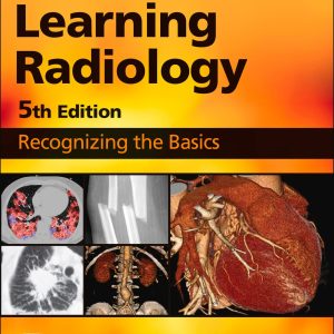 Learning Radiology, 5th Edition (EPUB)