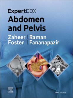 ExpertDDx: Abdomen and Pelvis, 3rd Edition (EPUB)