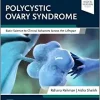 Polycystic Ovary Syndrome: Basic Science to Clinical Advances Across the Lifespan (Original PDF from Publisher)