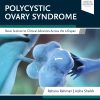 Polycystic Ovary Syndrome: Basic Science to Clinical Advances Across the Lifespan (EPUB)