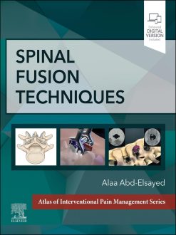 Spinal Fusion Techniques (EPUB)