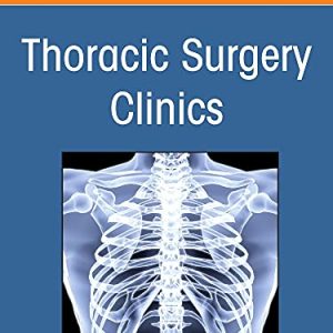 Lung Transplantation, An Issue of Thoracic Surgery Clinics (Volume 32-2) (The Clinics: Internal Medicine, Volume 32-2) (Original PDF from Publisher)