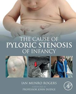 The Cause of Pyloric Stenosis of Infancy (Original PDF from Publisher)