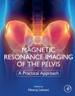 Magnetic Resonance Imaging of The Pelvis: A Practical Approach (EPUB)