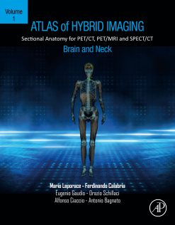 Atlas of Hybrid Imaging Sectional Anatomy for PET/CT, PET/MRI and SPECT/CT Vol. 1: Brain and Neck: Sectional Anatomy for PET/CT, PET/MRI and SPECT/CT (EPUB)