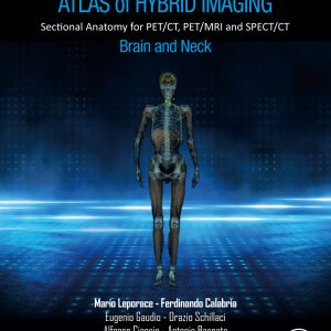 Atlas of Hybrid Imaging Sectional Anatomy for PET/CT, PET/MRI and SPECT/CT Vol. 1: Brain and Neck: Sectional Anatomy for PET/CT, PET/MRI and SPECT/CT (EPUB)
