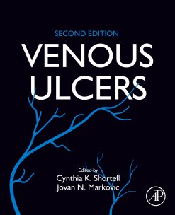 Venous Ulcers, 2nd Edition (EPUB)