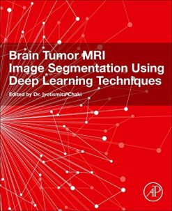 Brain Tumor MRI Image Segmentation Using Deep Learning Techniques (Original PDF from Publisher)