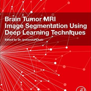 Brain Tumor MRI Image Segmentation Using Deep Learning Techniques (Original PDF from Publisher)