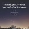 Spaceflight Associated Neuro-Ocular Syndrome (Original PDF from Publisher)