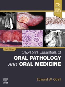 Cawson’s Essentials of Oral Pathology and Oral Medicine, 10th Edition (Original PDF from Publisher)