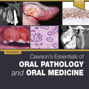 Cawson’s Essentials of Oral Pathology and Oral Medicine, 10th Edition (Original PDF from Publisher)