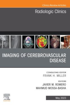 Imaging of Cerebrovascular Disease, An Issue of Radiologic Clinics of North America (Original PDF from Publisher)