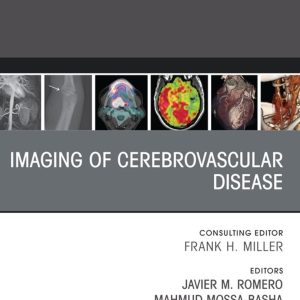 Imaging of Cerebrovascular Disease, An Issue of Radiologic Clinics of North America (Original PDF from Publisher)