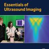 Essentials of Ultrasound Imaging (EPUB)