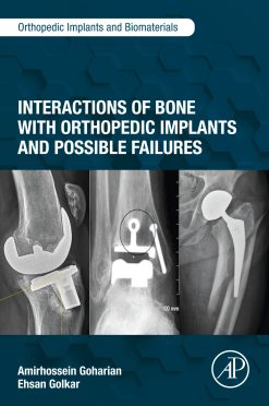 Interactions of Bone with Orthopedic Implants and Possible Failures (Original PDF from Publisher)