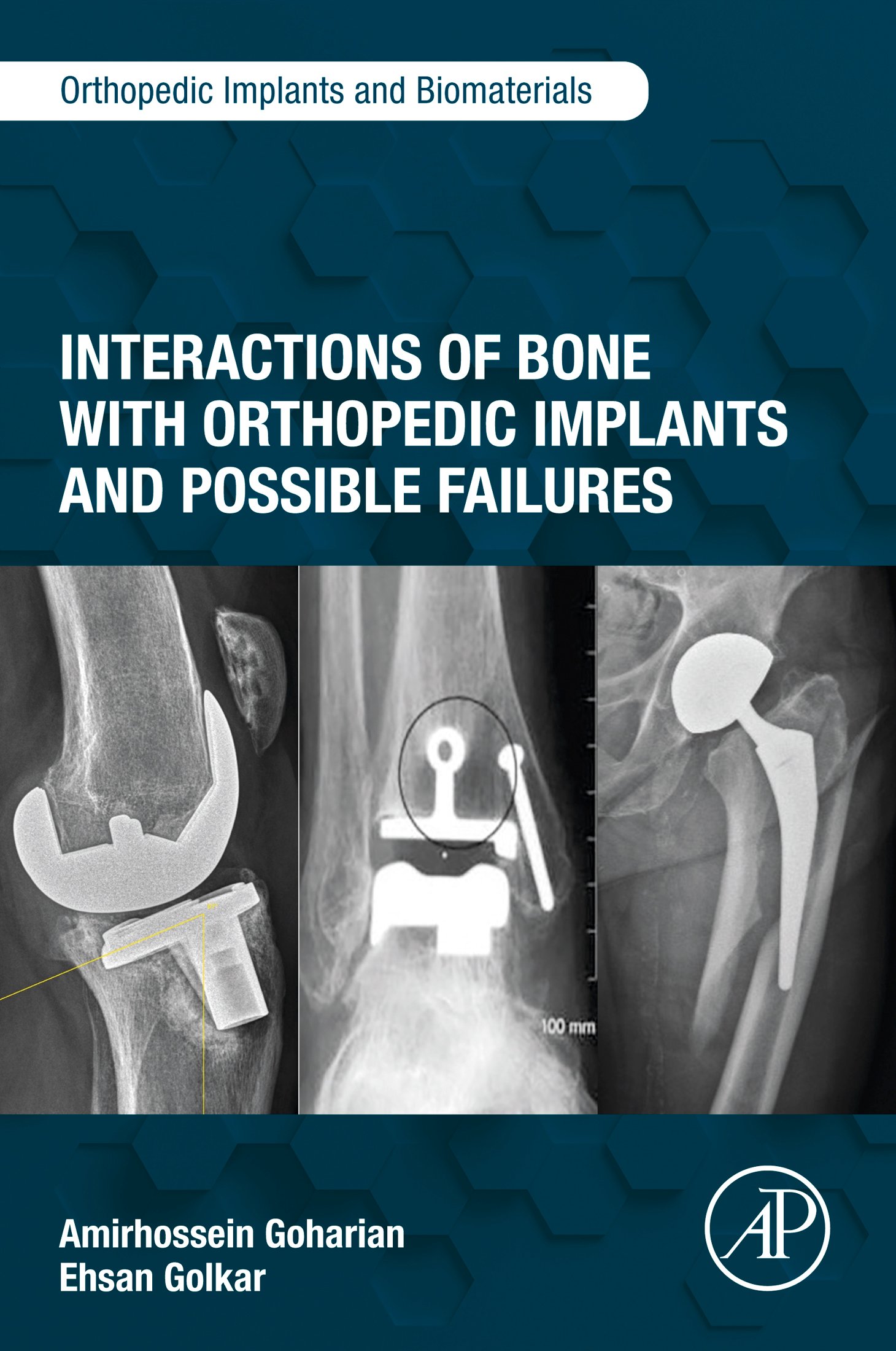 Interactions of Bone with Orthopedic Implants and Possible Failures (Original PDF from Publisher)