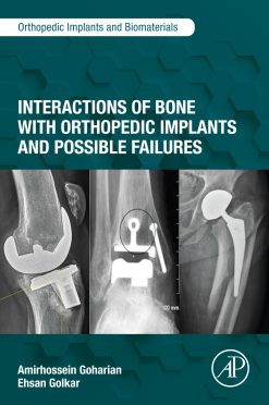 Interactions of Bone with Orthopedic Implants and Possible Failures (EPUB)