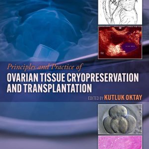 Principles and Practice of Ovarian Tissue Cryopreservation and Transplantation (EPUB)