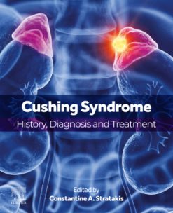 Cushing Syndrome (Original PDF from Publisher)