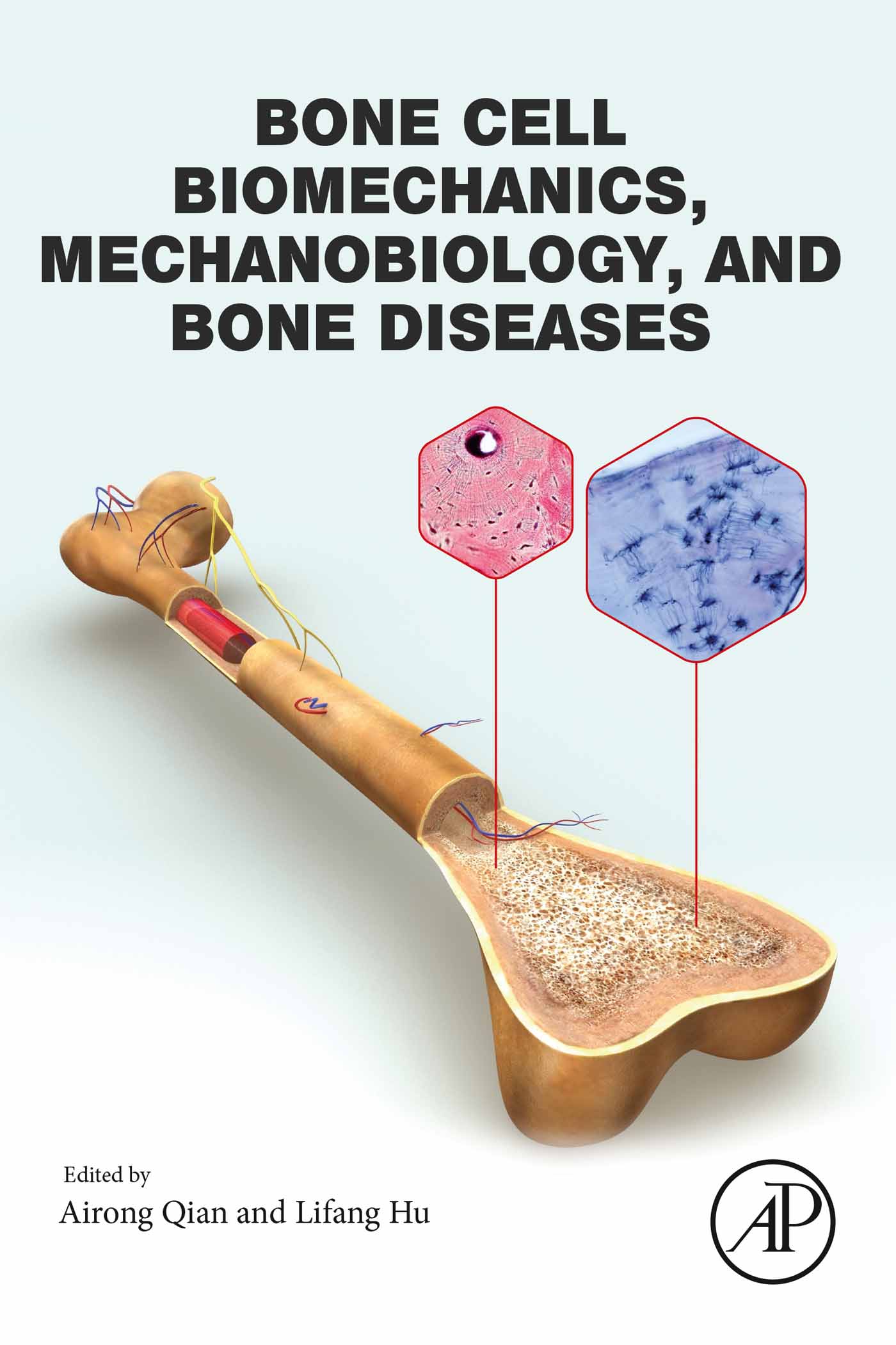 Bone Cell Biomechanics, Mechanobiology and Bone Diseases (EPUB)