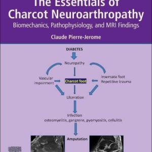 The Essentials of Charcot Neuroarthropathy: Biomechanics, Pathophysiology, and MRI Findings (Original PDF from Publisher)