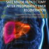 Safe Major Hepatectomy after Preoperative Liver Regeneration: Preopearative PVE, Two-Satage Hepatetomy, ALPPS and Hepatic Vein Deprivation (Original PDF from Publisher)