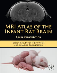 MRI Atlas of the Infant Rat Brain: Brain Segmentation (Original PDF from Publisher)