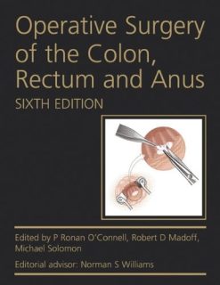 Operative Surgery of the Colon, Rectum and Anus, 6th Edition (Original PDF from Publisher)