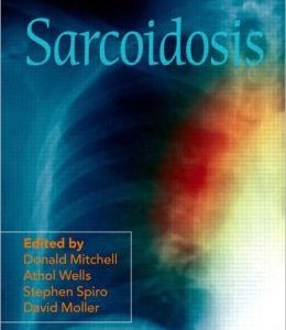 Sarcoidosis