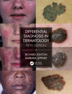 Differential Diagnosis in Dermatology, 5th Edition (Original PDF from Publisher)