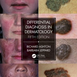 Differential Diagnosis in Dermatology, 5th Edition (Original PDF from Publisher)