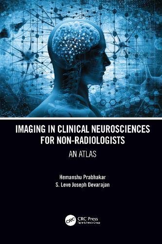 Imaging in Clinical Neurosciences for Non-radiologists: An Atlas (EPUB)