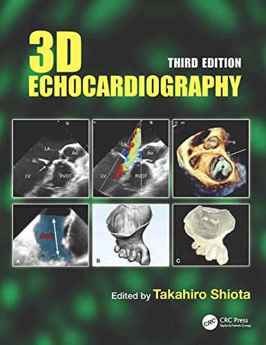 3D Echocardiography, 3rd edition (Original PDF from Publisher)