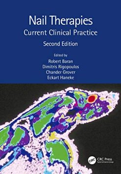 Nail Therapies: Current Clinical Practice, 2nd Edition (Original PDF from Publisher)